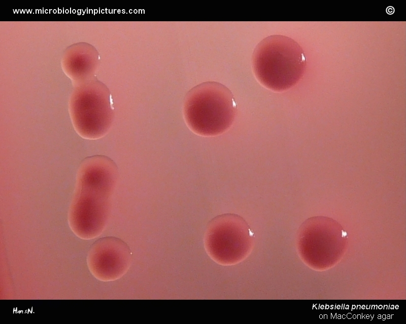 appearance of lactose-positive colonies on agar